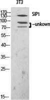 SIP1 Polyclonal Antibody