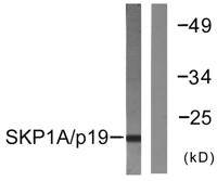 Skp1 p19 Polyclonal Antibody