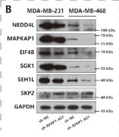 Skp2 p45 Polyclonal Antibody