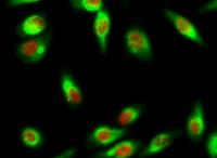 Skp2 p45 Polyclonal Antibody