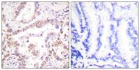 Skp2 p45 Polyclonal Antibody