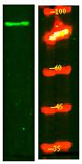 SL9A2 Polyclonal Antibody