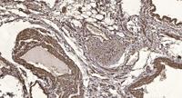 SLC10A7 Polyclonal Antibody