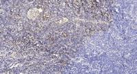Slit3 Polyclonal Antibody