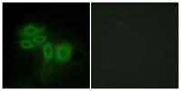 SLK Polyclonal Antibody