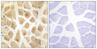 SLK Polyclonal Antibody