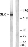 SLK Polyclonal Antibody