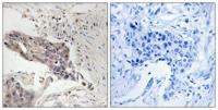 SLP-76 Polyclonal Antibody