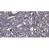 Smad1 Polyclonal Antibody