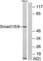 Smad1/5/9 Polyclonal Antibody
