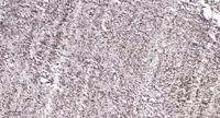 Smad1/5/9 Polyclonal Antibody