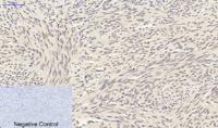 Smad3 Polyclonal Antibody