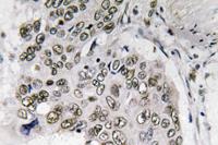 Smad6 Polyclonal Antibody