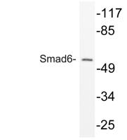 Smad6 Polyclonal Antibody
