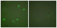SMAP45 Polyclonal Antibody