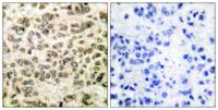 SMAP45 Polyclonal Antibody