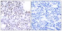 SMC1 Polyclonal Antibody