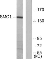 SMC1 Polyclonal Antibody