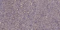 SMIT Polyclonal Antibody