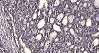 sMtCK Polyclonal Antibody