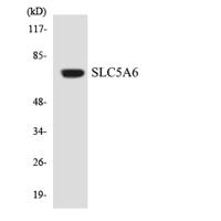 SMVT Polyclonal Antibody