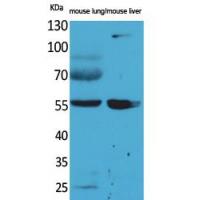 ALDH1A1 Polyclonal Antibody