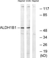 ALDH1B1 Polyclonal Antibody