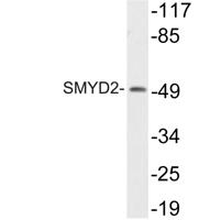 SMYD2 Polyclonal Antibody