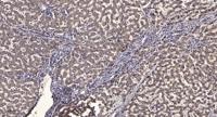 SMYD2 Polyclonal Antibody