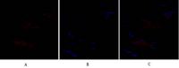 SNAI 1 Polyclonal Antibody