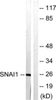 SNAI 1 Polyclonal Antibody