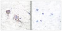 SNAP 25 Polyclonal Antibody