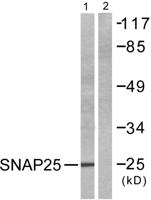 SNAP 25 Polyclonal Antibody