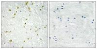 SNAPC 19 Polyclonal Antibody