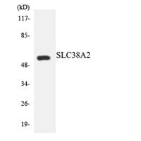 SNAT2 Polyclonal Antibody