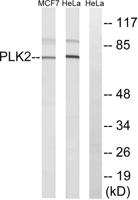 Snk Polyclonal Antibody