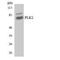Snk Polyclonal Antibody