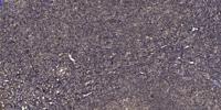 Snk Polyclonal Antibody