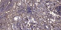 SNM1B Polyclonal Antibody