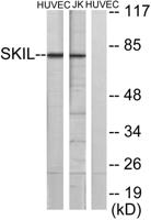 SnoN Polyclonal Antibody