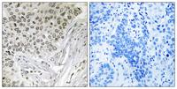 Snrp116 Polyclonal Antibody