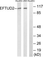Snrp116 Polyclonal Antibody