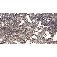 SNRPN Polyclonal Antibody
