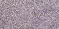 SNX1 Polyclonal Antibody