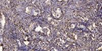 SNX4 Polyclonal Antibody