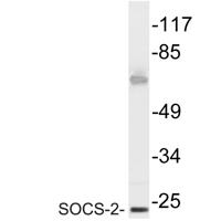 SOCS-2 Polyclonal Antibody