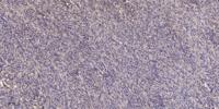 SOCS-2 Polyclonal Antibody