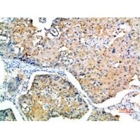 SOCS-3 Polyclonal Antibody