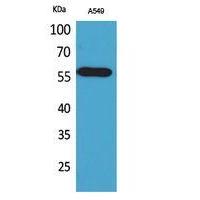 ALDH2 Polyclonal Antibody