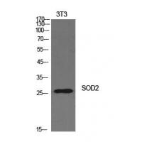 SOD-2 Polyclonal Antibody
